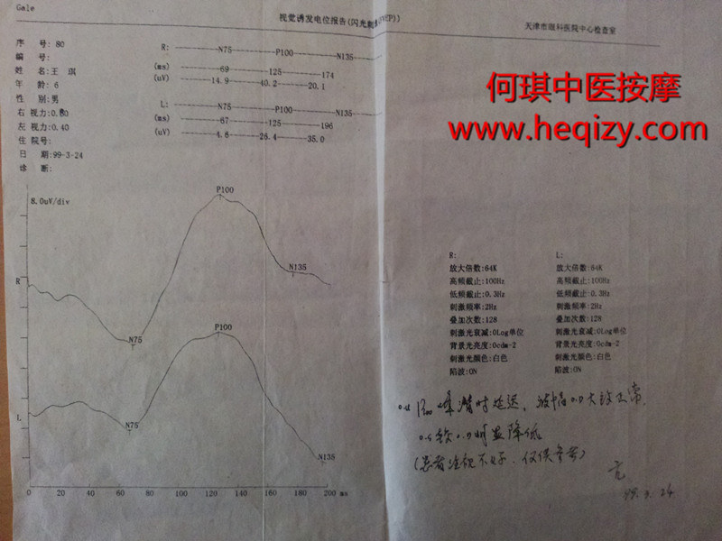 天津市何琪中医按摩治疗眼球震颤的案例之一