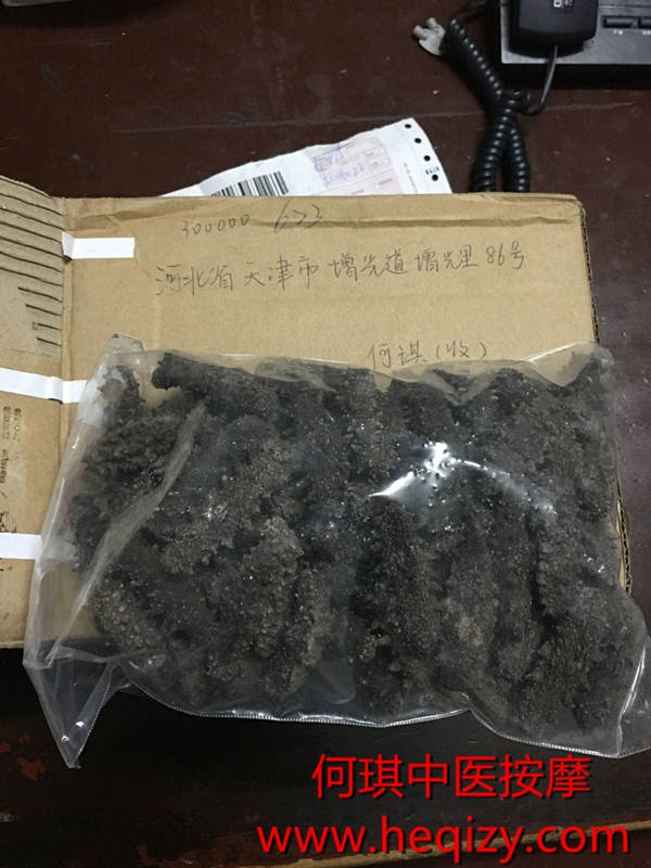 天津市何琪中医按摩治疗视神经萎缩的案例之一